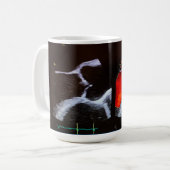 Aoraler Doppler-Echokardiogramm-Becher Kaffeetasse (Vorderseite Links)