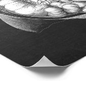 Aorta abdominale Anatomie Poster (Ecke)