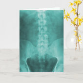 Aqua-Digital-Röntgenstrahl-Kunst-Gruß-Karte Karte (Gelbe Blume)