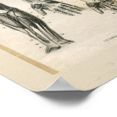 Armmuskeln Vintage Anatomie Druck Poster (Ecke)