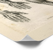 Armmuskeln Vintage Anatomie Druck Poster (Ecke)