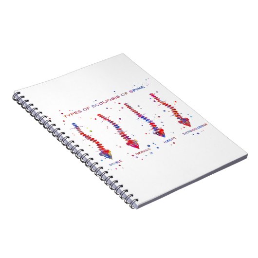 Art von Skoliose des Dorns Notizblock (Rechte Seite)