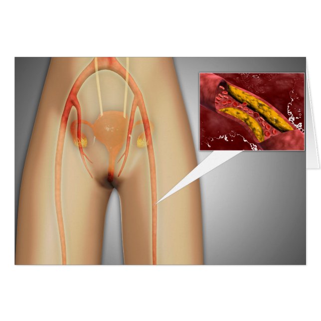 Arterie nahe Leg Nah-up (Vorderseite (Horizontal))
