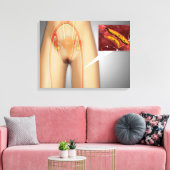 Arterie nahe Leg Nah-up Leinwanddruck (Insitu (Wohnzimmer))