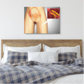 Arterie nahe Leg Nah-up Leinwanddruck (Insitu (Schlafzimmer))