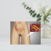 Arterie nahe Leg Nah-up Postkarte (Stehend Vorderseite)