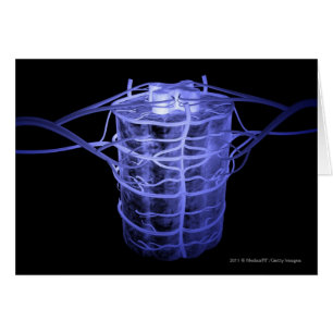 Arterien, die Teil der Wirbelsäule umgeben