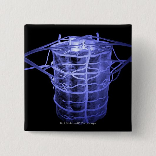 Arterien, die Teil der Wirbelsäule umgeben Button (Vorderseite)