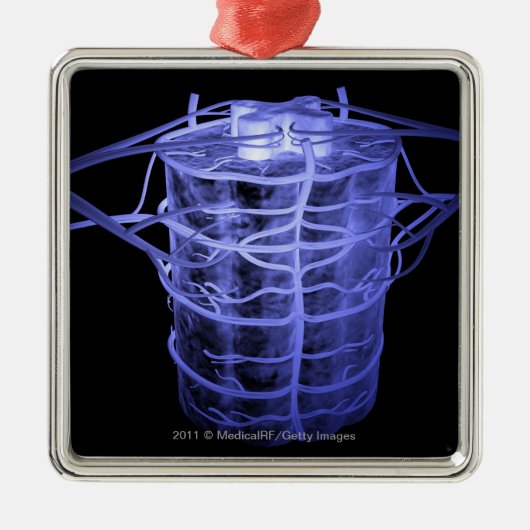 Arterien, die Teil der Wirbelsäule umgeben Silbernes Ornament (Vorne)