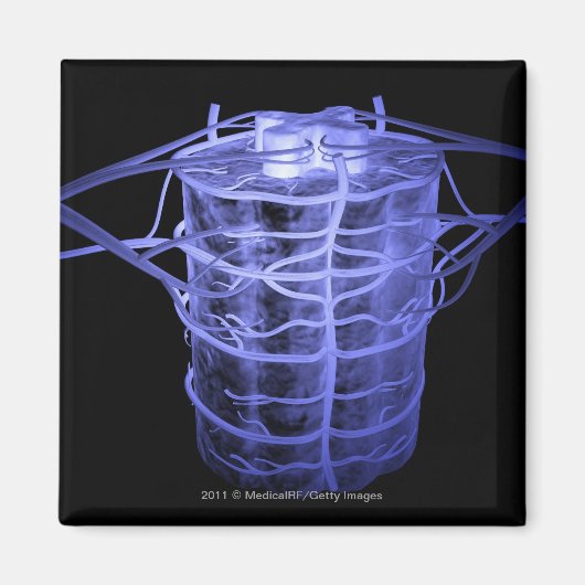 Arterien rund um einen Teil der Wirbelsäule Magnet (Vorne)