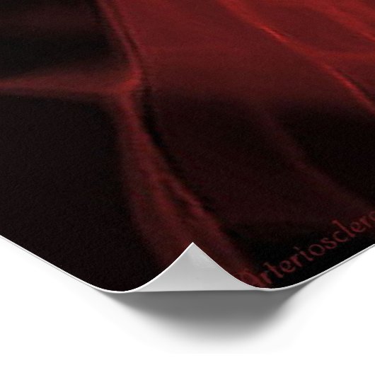 Arteriosklerose Poster (Ecke)