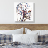 Ärztliche Veranschaulichung der Kopfschmerzen 1 Leinwanddruck (Insitu (Schlafzimmer))