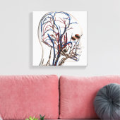 Ärztliche Veranschaulichung der Kopfschmerzen 1 Leinwanddruck (Insitu (Wohnzimmer))