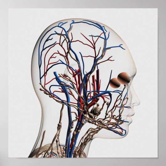 Ärztliche Veranschaulichung der Kopfschmerzen 1 Poster (Vorne)