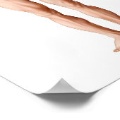 Ärztliche Veranschaulichung einer Anlage Poster (Ecke)