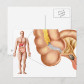 Ärztliche Veranschaulichung einer Anlage Postkarte (Vorne/Hinten)