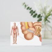 Ärztliche Veranschaulichung einer Anlage Postkarte (Stehend Vorderseite)