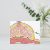 Aspiration der feinen Nadel Postkarte (Stehend Vorderseite)