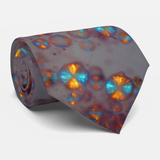 Asteroidhyalose (Polarisationsmikroskopie) Krawatte (Gerollt)