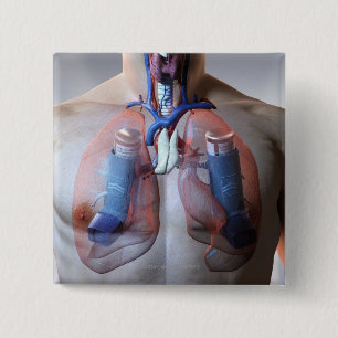 Asthma Button