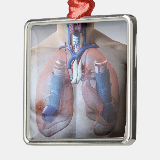 Asthma Silbernes Ornament (Links)