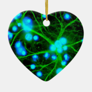 Astrocyte sind sternförmige Glial Zellen im Gehir Keramikornament