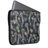 Ätherische Quallen und Anemone in Aquamarin und ro Laptopschutzhülle (Vorne Rechts)