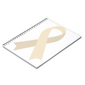 Atrophie der Cream Ribbon-degenerativen Diskette Notizblock (Linke Seite)