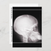 Aufnahme mit Foot in Mundröntgen Einladung (Vorne/Hinten)