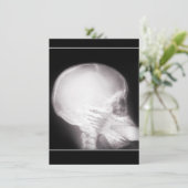 Aufnahme mit Foot in Mundröntgen Einladung (Stehend Vorderseite)