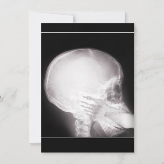 Aufnahme mit Foot in Mundröntgen Einladung (Vorderseite)