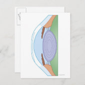 Auge nach korrekter Operation Postkarte (Vorne/Hinten)