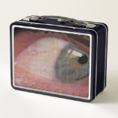 Augenbelastung Metall Brotdose (Rückseite)