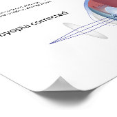 Augendefekt Presbyopia Poster (Ecke)
