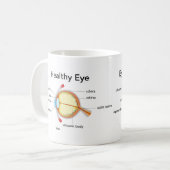 Augendiagramm für Glaukom und gesundes Auge Kaffeetasse (Vorderseite Links)