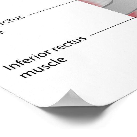 Augenkonjunktiva Anatomie Poster (Ecke)