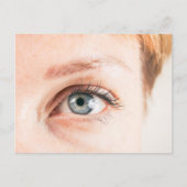 Augennähe Postkarte (Vorderseite)