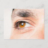 Augennähe Postkarte (Vorderseite)
