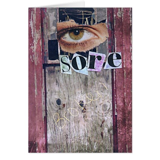 Augentenkollusion (Vorne)