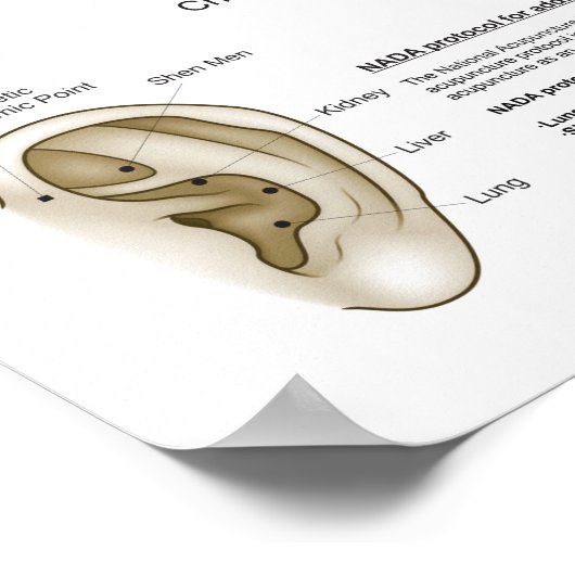 Auriculotherapy Ear Acupuncture Poster (Ecke)