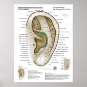 Auriculotherapy Ear Acupuncture Poster (Vorne)