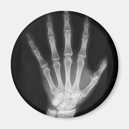 B&W Röntgen Skeleton Hand Magnet (Vorne)