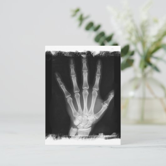B&W Röntgen Skeleton Hand Postkarte (Stehend Vorderseite)