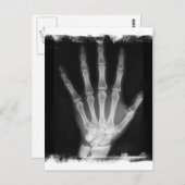 B&W Röntgen Skeleton Hand Postkarte (Vorne/Hinten)