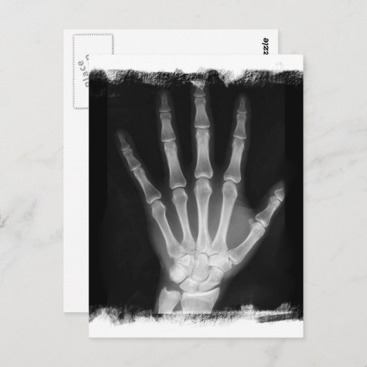 B&W Röntgen Skeleton Hand Postkarte (Vorne/Hinten)