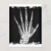 B&W Röntgen Skeleton Hand Postkarte (Vorderseite)