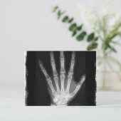 B&W Röntgen Skeleton Hand Postkarte (Stehend Vorderseite)
