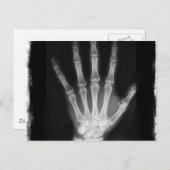 B&W Röntgen Skeleton Hand Postkarte (Vorne/Hinten)