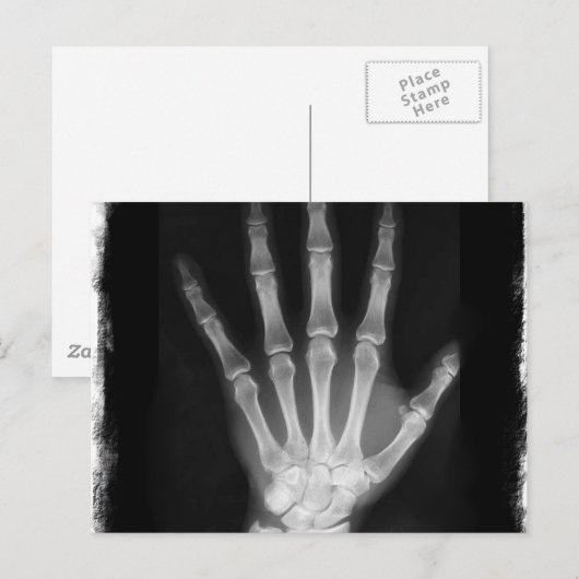 B&W Röntgen Skeleton Hand Postkarte (Vorne/Hinten)