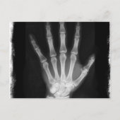 B&W Röntgen Skeleton Hand Postkarte (Vorderseite)